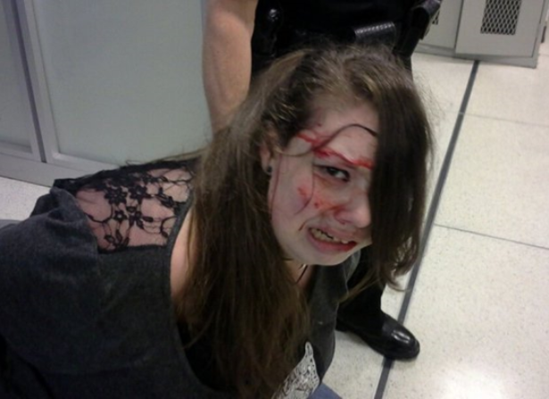 صور صادمة.. فتاة أبرحها أمن مطار أمريكي ضربا .. لكن المفاجأة كانت صادمة !