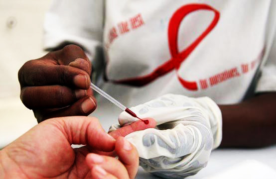 هزيمة جديدة للإيدز بشفاء ثالث شخص في العالم منه