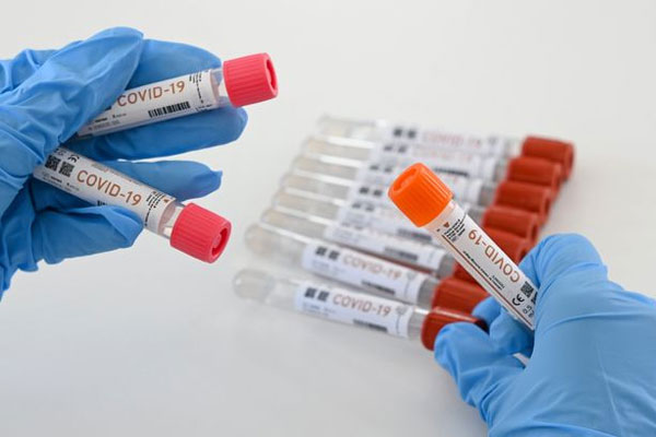 تسجيل حالتين جديدتين بفيروس كورونا يرفع الحصيلة باقليم شيشاوة إلى 128 مصابا وحالات التعافي تتجاوز 57 متعافيا