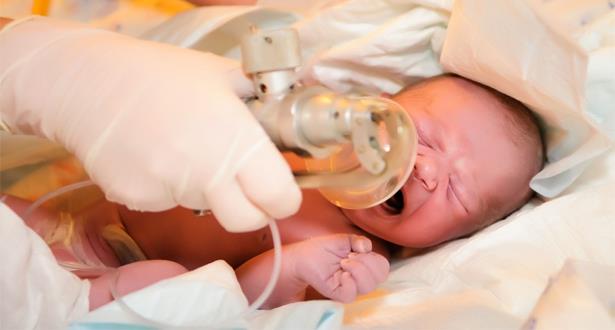 إجراء أول تقنية لعلاج اختناق حديثي الولادة بالمركز الاستشفائي الجامعي بمراكش
