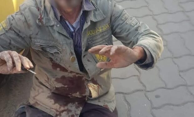 صور صادمة.. لص ”يُشرمل” سائق طاكسي بمراكش ويسرق كل ما بحوزته