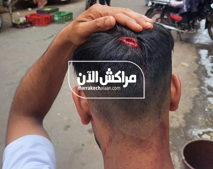خطير.. “بلطجي” يعتدي على شخصين بحي المسيرة بمراكش +صور