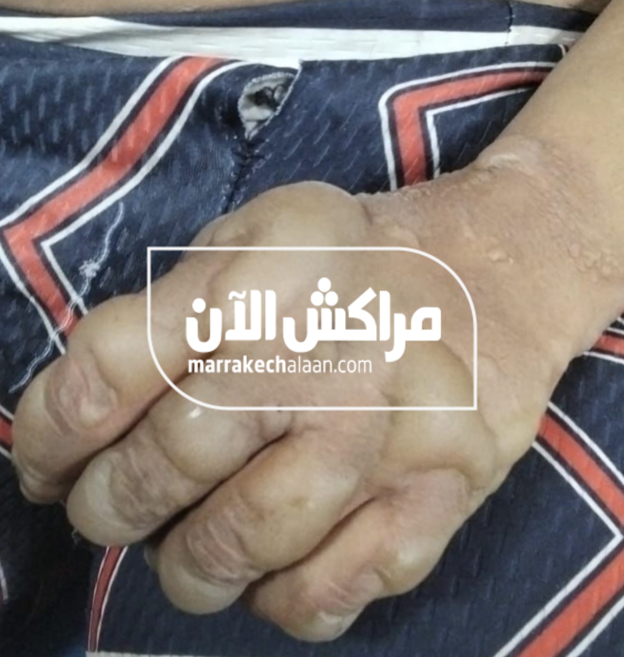 صادم بمراكش.. العثور على فتاة مختفية منذ أسبوعين في حالة خطيرة بجبل الكدية +صور حصرية