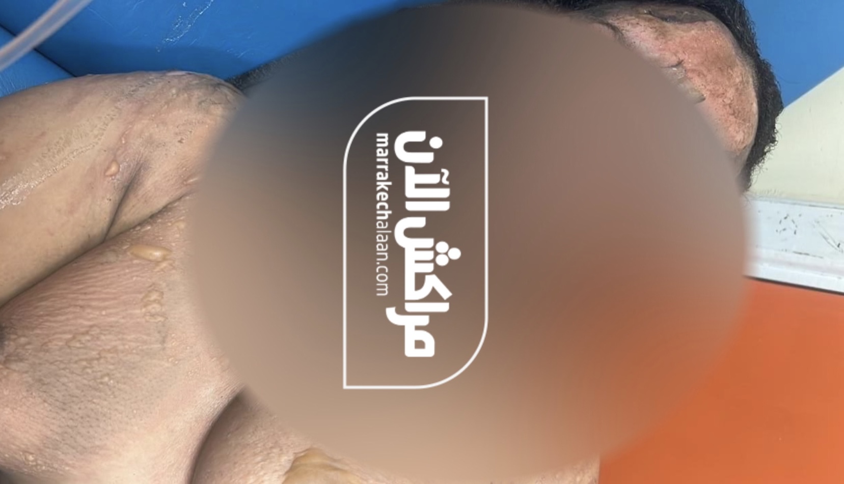 “مراكش الآن” تكشف تفاصيل العثور على فتاة مختفية بحالة صحية ونفسية حرجة