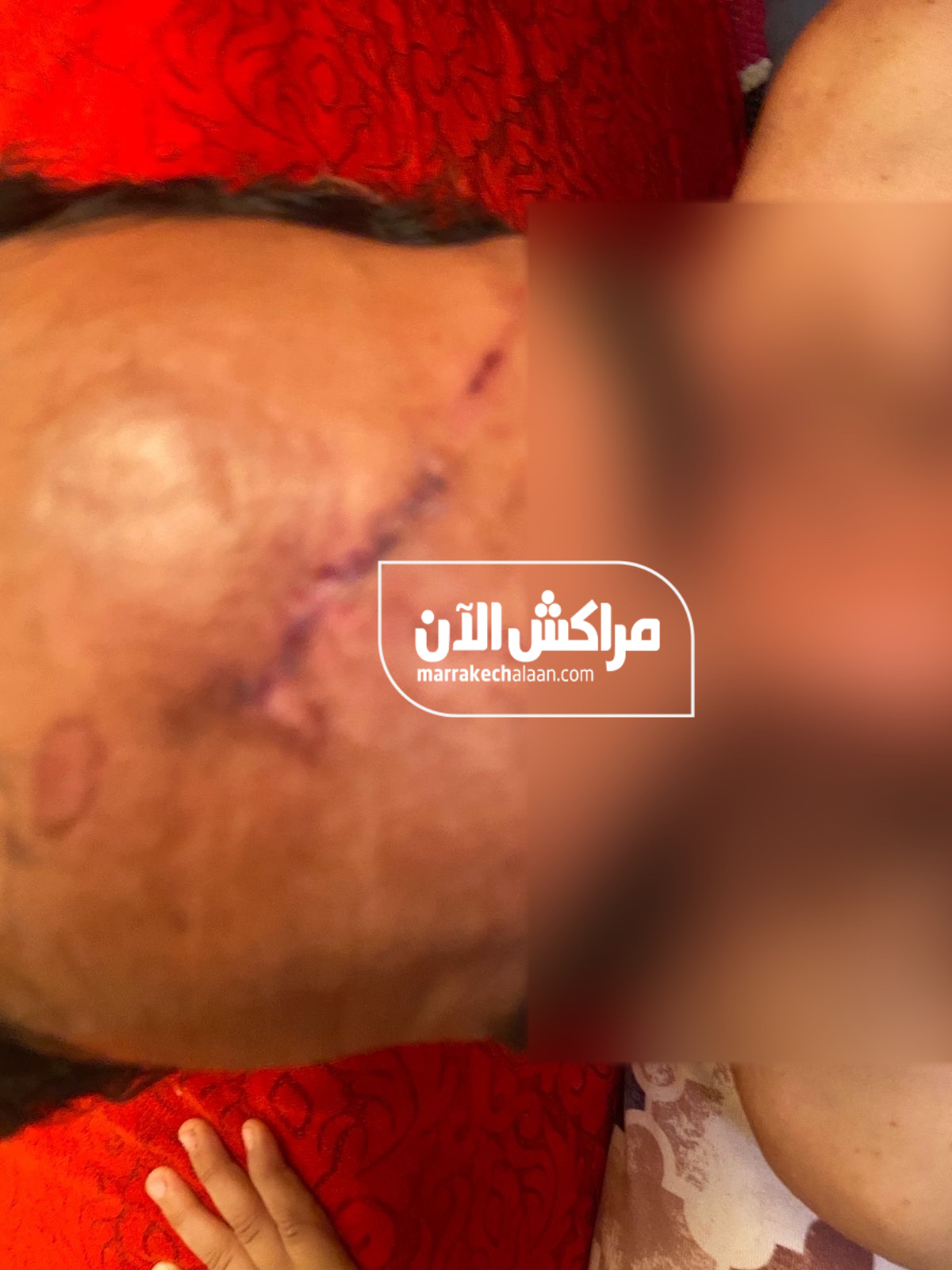 خطير.. بلطجي يعتدي على شقيق مؤثر مراكشي بدوار كنون