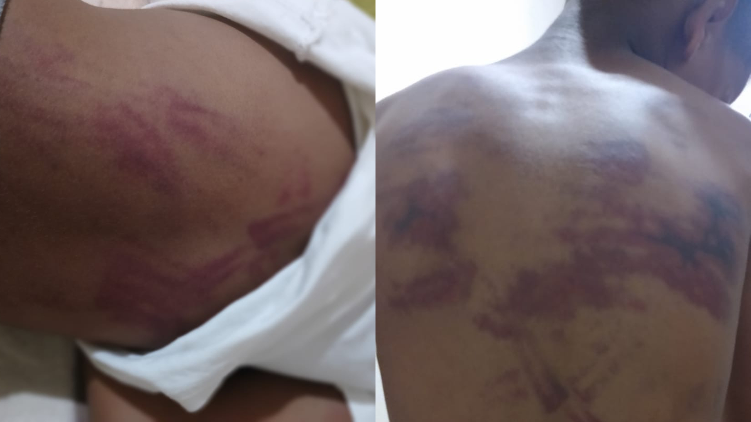 مراكش.. قاصر يتعرض للاعتداء بالضرب المبرح في حصة دروس الدعم ووالده يطالب بفتح تحقيق
