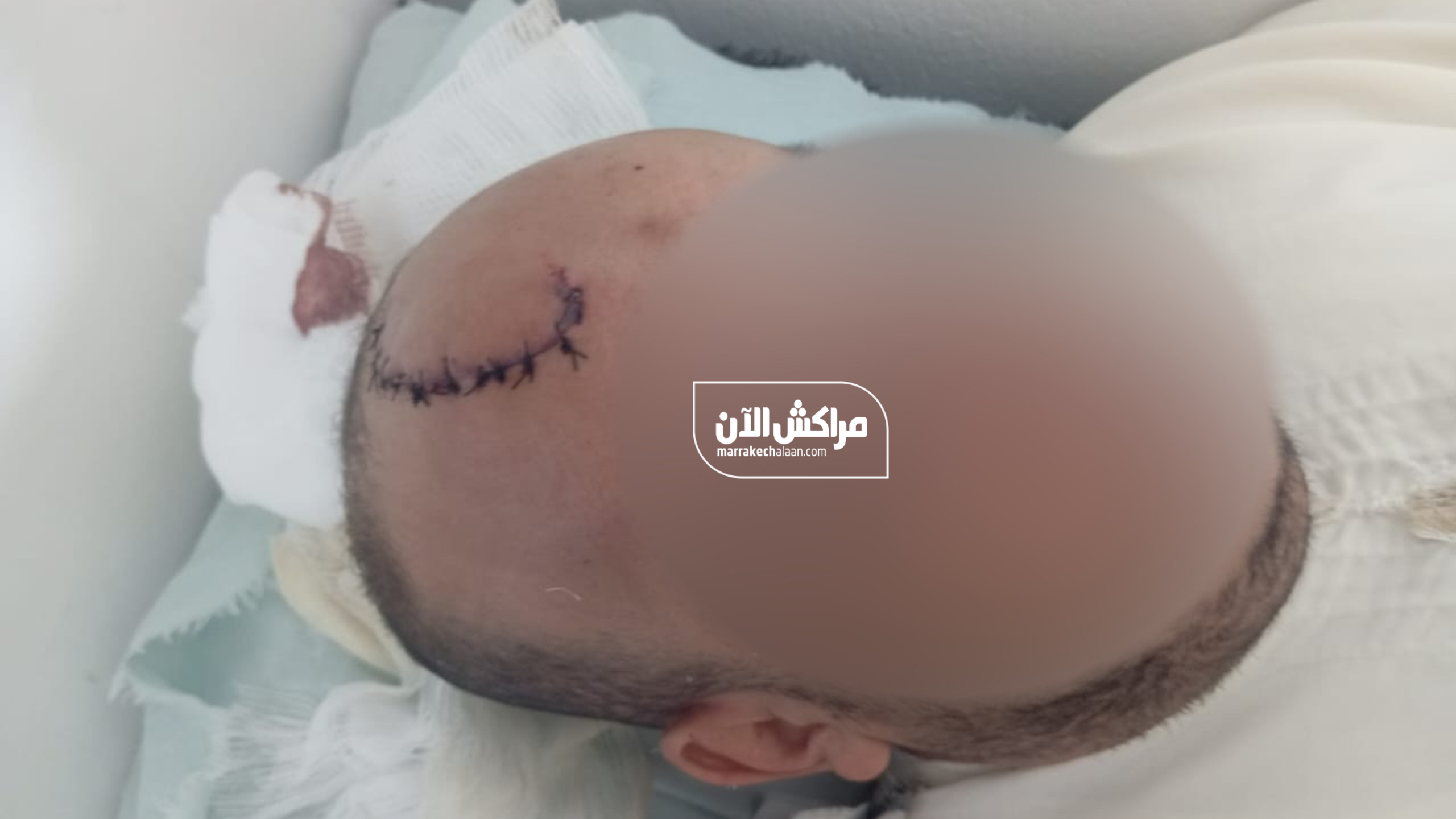 بالصور.. “مراكش الآن” تكشف تفاصيل جديدة في ملابسات اعتداء “الطعنة الغادرة” على فاعل جمعوي بشيشاوة
