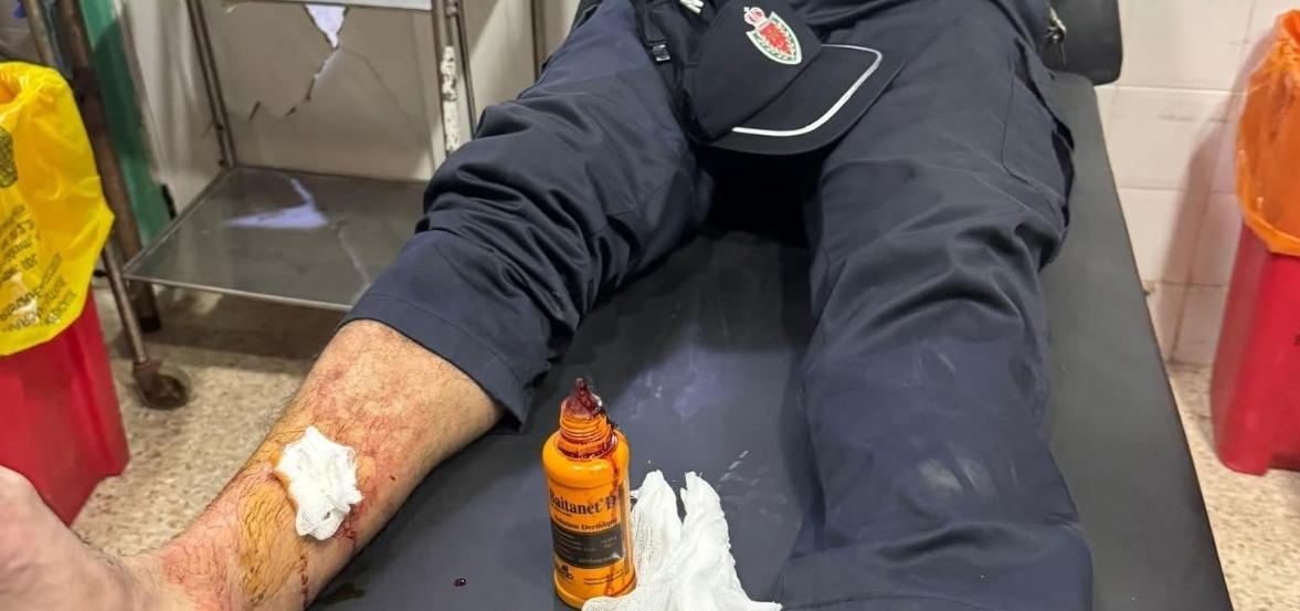 أحداث عنف وشغب ببركان.. إصابات بليغة في صفوف الأمن وصحفي وتخريب للممتلكات العامة