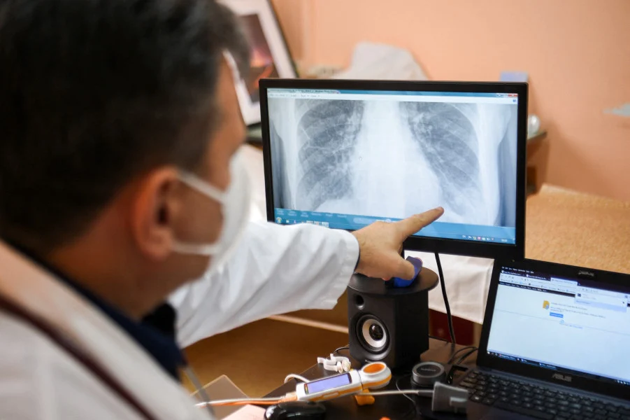 بريطانيا تعتزم اختبار الذكاء الاصطناعي لتسريع تشخيص سرطان الرئة
