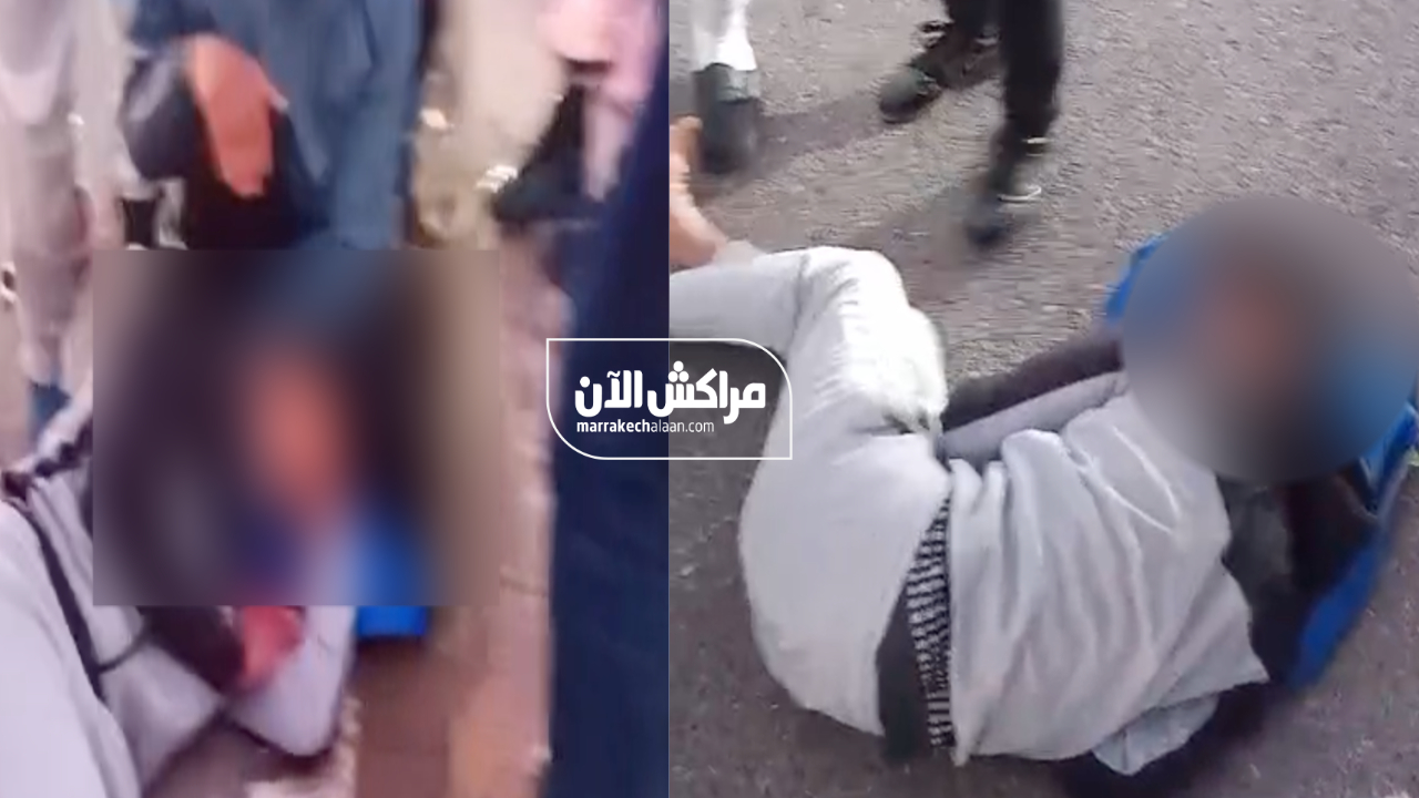 الشويطر.. حادثة سير بين دراجة النارية وسيارة للنقل المدرسي تنقل صاحب دراجة نارية للعناية المركزة +فيديو