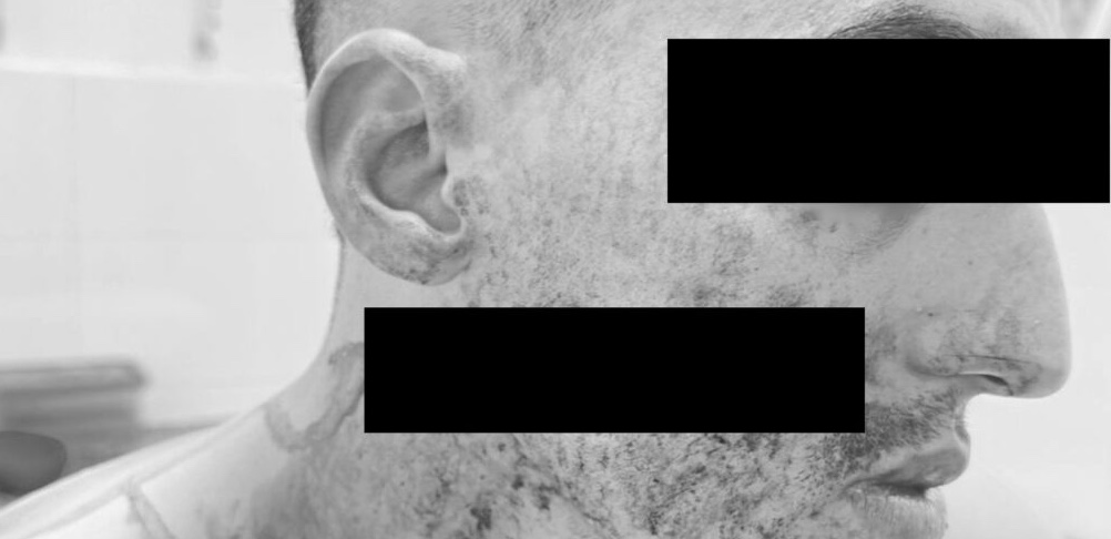 اعتداء دامي بسلاح أبيض يستنفر مصالح الدرك الملكي قبيل الإفطار