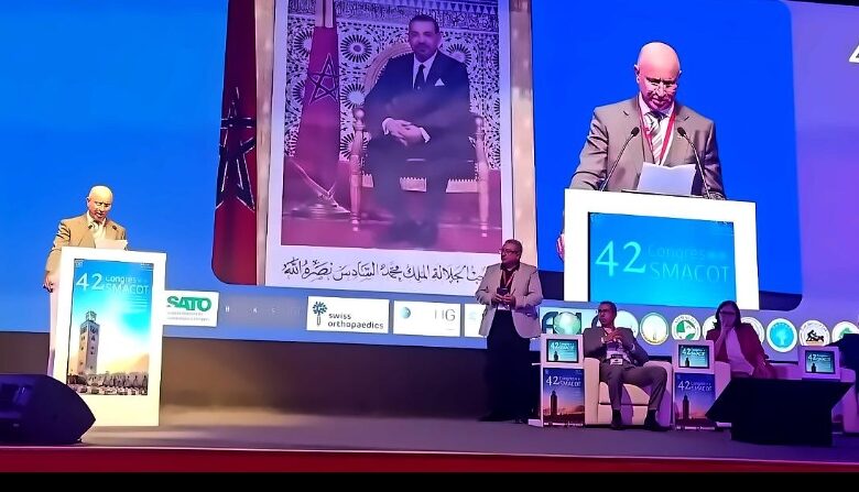 انطلاق المؤتمر ال 42 لجراحة العظام بمراكش وتركيز على التكوين والابتكار الطبي