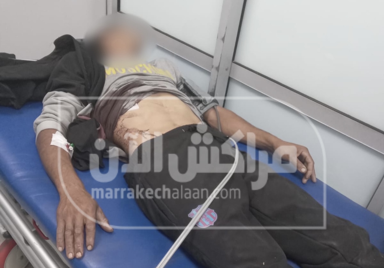 اعتداء بالسلاح الأبيض بتسلطانت والدرك الملكي يحقق في الواقعة