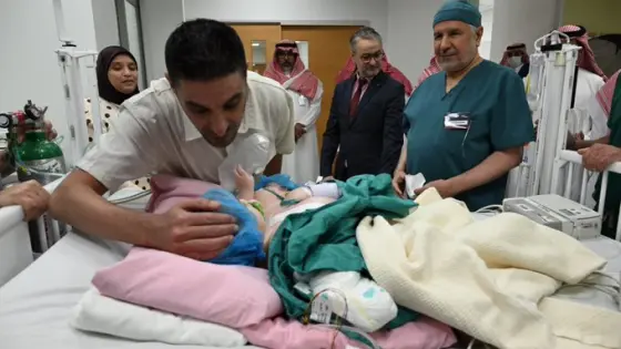 فريق طبي سعودي ينجح في فصل التوأم الملتصق المغربي “سجى وضحى”