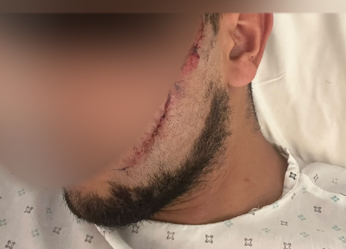 مراكش.. المصالح الأمنية تفتح بحثاً وتصدر مذكرة بحث في حق عامل فندقي إثر اعتداء على متدرب